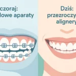 Nowoczesne metody leczenia ortodontycznego, które warto znać